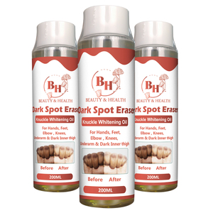 Aceite Blanqueador de Semillas de Vitamina E Frescas de Marca Privada, Reducción Efectiva de Manchas Oscuras, Reducción de Melanina, Blanqueamiento de Piernas y Codos, Esencial Puro - Product Image 6