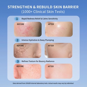 Suero de ADN de Salmón PDRN OEM de 5 ml, Grado Médico, Reparación Facial de la Piel, Esencia con Ácido Hialurónico para el Área de los Ojos, para Derma Rolling - Product Image 4