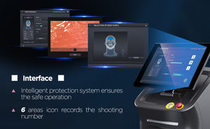 ADSS Mesin Penghilang Bulu Permanen <span class=keywords><strong>Laser</strong></span> Diode <span class=keywords><strong>808nm</strong></span> Portabel Paling Populer - Product Image 3