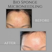 Poudre exfoliante bio de spicules d'éponge hydrolysée à 40-99% pour micro-aiguilletage, traitement exfoliant pour la peau à base d'algues Spongilla, OEM