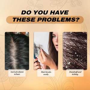 น้ำมันบำรุงผมสูตรผสมหลายชนิด 30 มล. รับผลิตแบบ OEM แบรนด์ส่วนตัว น้ำมันละหุ่ง โรสแมรี่ หัวหอม ไบโอติน วีแกน ป้องกันผมชี้ฟู - Product Image 5