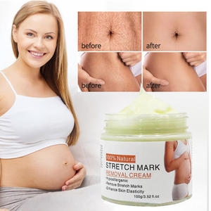 Organik doğal gebelik streç işareti krem anti-skar kaldırma vücut losyonu yumuşatma nemlendirici streç işareti krem ile - Product Image 3
