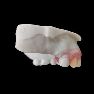 Vente en gros de prothèses dentaires Valplast amovibles flexibles en acrylique, externalisation de laboratoire dentaire en Chine, prix bon marché pour Agnet dentaire - Product Image 4