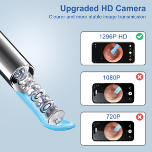 Nettoyeur d'oreille visuel intelligent sans fil 1296P Ultra HD Bâton d'oreille Otoscope Outil d'élimination de la cire Caméra Endoscope auriculaire - Product Image 3