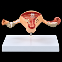Modèle d'ovaire, modèle anatomique de l'organes reproducteurs féminins, outil éducatif médical