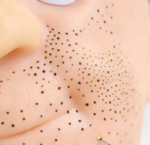 Juguete Sensorial Antiestrés de Silicona para Apretar Granos y Espinillas con Inyecciones - Modelo de Acné - Product Image 5