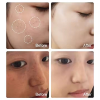 Sérum Coréen au Glutathion et à l'Acide Kojique pour les Soins de la Peau, Sérum Facial Éclaircissant Anti-Âge pour Éliminer les Taches Brunes