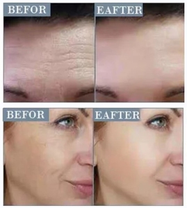 Hot!!! Serum 24K Peptide Hyaluronic Acid 24K Dành Cho Da Mặt Collagen Dưỡng Ẩm Phân Tử Nhỏ Dành Cho Da Mặt OEM/ODM Loại Bỏ Quầng Thâm - Product Image 6