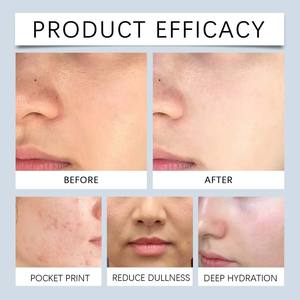 โทนเนอร์ OEM/ODM ซีโร่ พอร์ 100 มล. AHA BHA PHA ไนอะซินาไมด์ แพนทีนอล <span class=keywords><strong>ผ</strong></span>ลัดเซลล์<span class=keywords><strong>ผ</strong></span>ิว ช่วยเติมความชุ่มชื้น ควบคุมความมัน ดูแลรูขุมขน <span class=keywords><strong>ผ</strong></span>ิวเรียบเนียนทุกสภาพผิว - Product Image 5