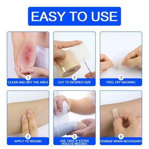 Rollo de Hidrocoloide Mejorado para el Cuidado de Heridas, 5 cm x 16 pies, Parches Autoadhesivos para Todo Tipo de Piel y Adultos - Product Image 4