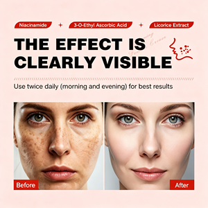 Crème pour le visage ZLZR contre les taches de rousseur, équilibrante pour le teint, hydratante, raffermissante, pour une peau douce et lisse, nettoyage en profondeur, soin du visage, 20g - Product Image 4