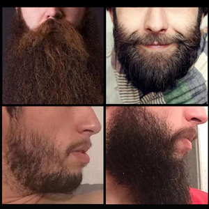 <span class=keywords><strong>Set</strong></span> Professionale per la Crescita della <span class=keywords><strong>Barba</strong></span> con Siero Naturale Organico Vegano <span class=keywords><strong>e</strong></span> Detergente con Formula Erboristica Rinfrescante per la Cura Maschile - Product Image 5