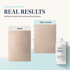 Tónico <span class=keywords><strong>para</strong></span> <span class=keywords><strong>Piscinas</strong></span> de Marca Privada, Limpiador de Poros, Eliminador de Células Muertas de la Piel, Textura de Piel Radiante - Product Image 5