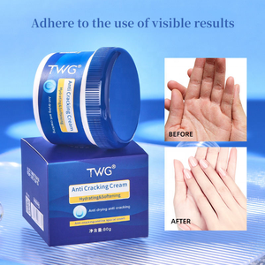 Crème pour les pieds anti-fissures TWG RTS, crème pour les mains anti-gerçures, hydratant pour tout le corps, crème pour les mains et les pieds anti-écaillage - Product Image 3
