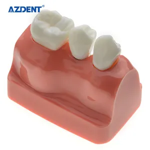 Hoge Kwaliteit Dental Study Model / Crystal Implant Verwijderbare Studie Gebruik Menselijk Tanden Model