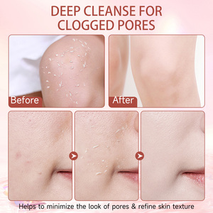 IKZEE Venta al Por Mayor <span class=keywords><strong>Gel</strong></span> Peeling Limpiador <span class=keywords><strong>Hidratante</strong></span> Exfoliante <span class=keywords><strong>Facial</strong></span> Suave Purificante - Product Image 6