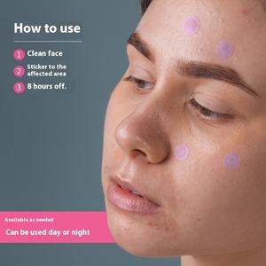 Pasta <span class=keywords><strong>para</strong></span> el acné con microagujas solubles en rosa personalizable, corrector Invisible <span class=keywords><strong>de</strong></span> <span class=keywords><strong>ácido</strong></span> <span class=keywords><strong>hialurónico</strong></span>, parche <span class=keywords><strong>para</strong></span> el acné personalizado antiarrugas - Product Image 4