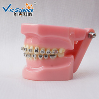 28 pièces de modèles d'appareils orthodontiques demi-métalliques et demi-céramiques pour l'entraînement en orthodontie des étudiants en dentisterie et la démonstration en laboratoire CE ROHS ISO