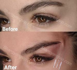 L REJEON 2-en-1 PDO Thread Lift Cog 4D L Blunt 21G 60mm Fox Eyes Logo personnalisé Dispositif de lifting facial sûr pour le raffermissement de la peau Utilisation en clinique - Product Image 3