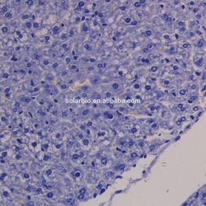 Solarbio High Quality Alpha-Diastase Solution 1% for Laboratory Reagent Scientific Research Raw <strong>Material</strong> Beijing Basic <strong>Dye</strong> - Product Image 3