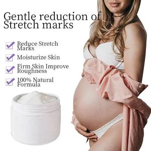 Potente eliminación de estrías, crema orgánica Natural para reparación de estiramiento de la piel, eliminación de estrías - Product Image 2