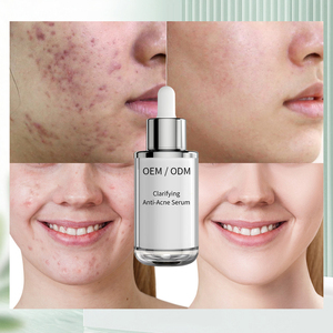 Esencia Herbal Profesional para el Acné, Material Prima para Reparación <span class=keywords><strong>de</strong></span> Marcas <span class=keywords><strong>de</strong></span> Acné y Comedones Cerrados, Venta <span class=keywords><strong>al</strong></span> <span class=keywords><strong>Por</strong></span> <span class=keywords><strong>Mayor</strong></span> - Product Image 2