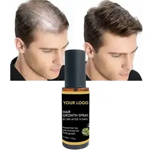 Saç çıkma yağı anti saç dökülmesi OEM/ODM saç tedavisi özel etiket büyüme sprey