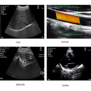 3 in 1 Ultrasound <span class=keywords><strong>Doppler</strong></span> warna Dual Head Convex dan Linear Handheld Ultrasound Probe untuk jantung/arteri/ginjal/HATI/Linux - Product Image 4