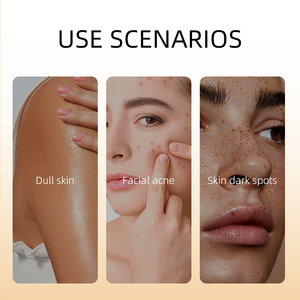Olio Corpo Vegano Naturale Personalizzato per lo Sbiancamento della Pelle con Curcuma, Limone e Oro 24K per Donne di Colore - Olio Anti-Età - Product Image 4