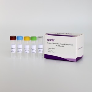 고감도 의사 바이러스 gB 유전자 qPCR 키트 | 50 테스트/CE 인증 - Product Image 1