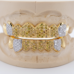 18K Or Diamant Grillz Argent Glacé Bijoux Hommes et Femmes Dents Grillz Pendentifs fins et breloques pour les deux sexes - Product Image 1