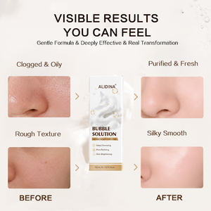 Solution de bulles liquides blanches, solution de petites bulles, soin de la peau, sérum nourrissant pour le visage, solution de peeling aquatique, solution pour appareil facial - Product Image 4