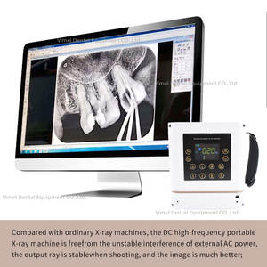 Macchina veterinaria a raggi <span class=keywords><strong>X</strong></span> attrezzatura dentale portatile a raggi <span class=keywords><strong>X</strong></span> 60KV 30Khz 0.4mm messa a fuoco per animali domestici - Product Image 3