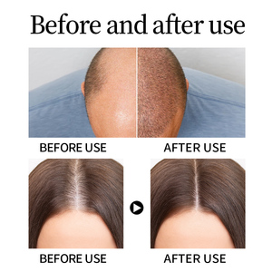 Großhandel 200ml Rosmarin-Haaröl zur Kopfhaut-Regeneration und Haarvitalisierung, Pflanzliche Pflege für Haarwachstum, Frisches Rosmarin-Haarwuchsöl für den Heimgebrauch - Product Image 3