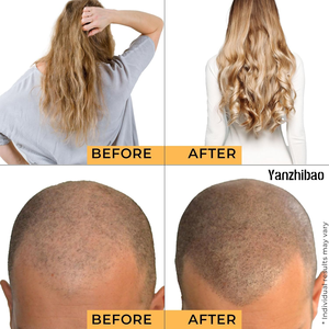 Aceite de Semillas de Calabaza 100% Puro Prensado <span class=keywords><strong>en</strong></span> Frío OEM, Suero para <span class=keywords><strong>el</strong></span> Cuidado de la Piel Sin Diluir, Antienvejecimiento, Reparación de Arrugas, Absorción Rápida, para <span class=keywords><strong>el</strong></span> Cabello - Product Image 5