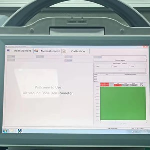 Amain <span class=keywords><strong>Densitometro</strong></span> <span class=keywords><strong>OSEO</strong></span> por ultrasonido portátil Escaner de densidad osea para clinica - Product Image 2