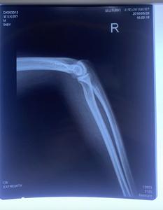 فيلم تغليف شفاف أزرق عالي الجودة مقاوم للماء وقابل للتمدد للاستخدام الطبي في أجهزة التصوير المقطعي بالأشعة المقطعية والرنين والأشعة السينية، سماكة 210 ميكرون، متوافق مع الحبر الصبغي - Product Image 5