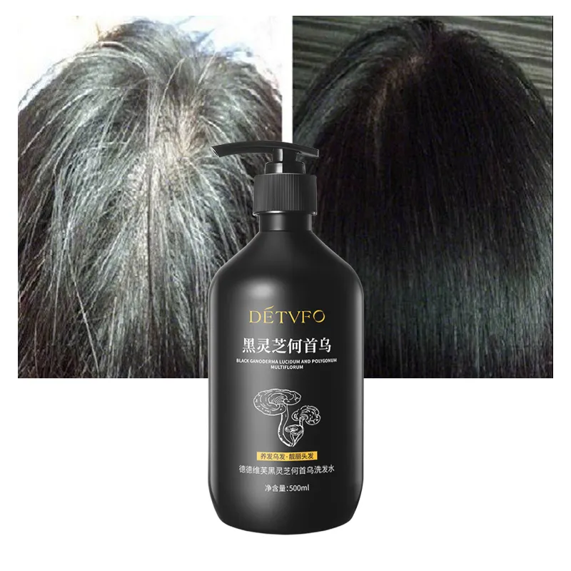Großhandel natürliches Haar wachsen Shampoo Haarausfall Bio Kräuter Ginseng Shampoo Haarwuchs Shampoo für Männer und Frauen
