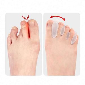 Correcteur d'orteils en silicone, portable et confortable, pour orteils arqués, soin des pieds, outil de réglage des hallux valgus - Product Image 5