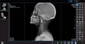 Detector de Panel Plano de Rayos X Médico, Sistema de Rayos X Digital Veterinario de Panel Plano, Detector de Panel Plano de Rayos X con Cable Cmos - Product Image 5