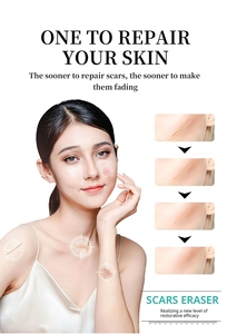 Crema Aclaradora para la Piel Postoperatoria para Quemaduras 50g Transfronteriza - Product Image 5