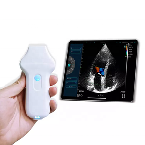 Konted MDR 2.2/3.6 Mhz warna Doppler genggam <span class=keywords><strong>Array</strong></span> perlengkapan medis ultrasound nirkabel C10UC untuk hati - Product Image 1