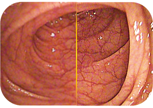 THR-OR1200 Hệ Thống Camera Nội Soi Thú Y HD Máy Chẩn Đoán Điện Tử Linh Hoạt - Product Image 4