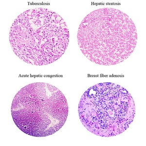 100個の人間の病気の病理学準備されたスライド準備された顕微鏡スライドを教える - Product Image 6