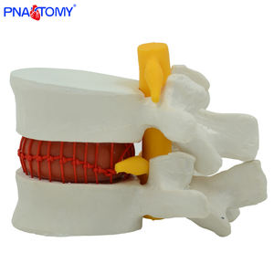 Modelo Lumbar <span class=keywords><strong>humano</strong></span> agrandado, <span class=keywords><strong>sistema</strong></span> esqueleto de Anatomía de la columna vertebral, PNT-0138 - Product Image 6
