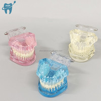 [Aifan Dental] estándar modelo de dientes práctica falsa dental M7001 modelo estándar Dental modelo