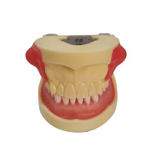 Modèle dentaire <span class=keywords><strong>maxillaire</strong></span> bilatéral pour la pratique de l'incision de la <span class=keywords><strong>kyste</strong></span> et de l'élimination du pur - Product Image 1