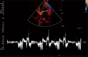 Dispositivos de Monitoreo Veterinario Sonoscape ProPet 60, Sistema de Ultrasonido de Diagnóstico Doppler a Color de 21.5 Pulgadas con Cinco Conectores de Sonda - Product Image 6