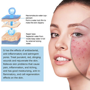 Sérum de soin de la peau 100% naturel à étiquette privée en gros, sérum anti-acné, contrôle de l'huile, éclaircissement des marques d'acné, réparation de la barrière cutanée - Product Image 2