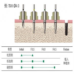 Original Universal One <strong>Guide</strong> Kit <strong>Dental</strong> <strong>Implant</strong> <strong>Surgical</strong> Complete Drill Bit Kit - Product Image 5